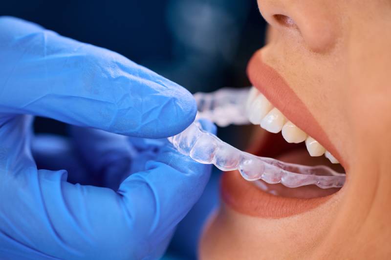 Your Invisalign| Invisalign treatment in Thornton